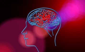 AVC : un traitement qui réduit l’œdème cérébral