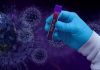 Covid-19 : 1/3 des patients développent des troubles neurologiques Covid-19 : 1/3 des patients développent des troubles neurologiques
